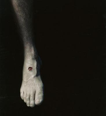 [VIDE]